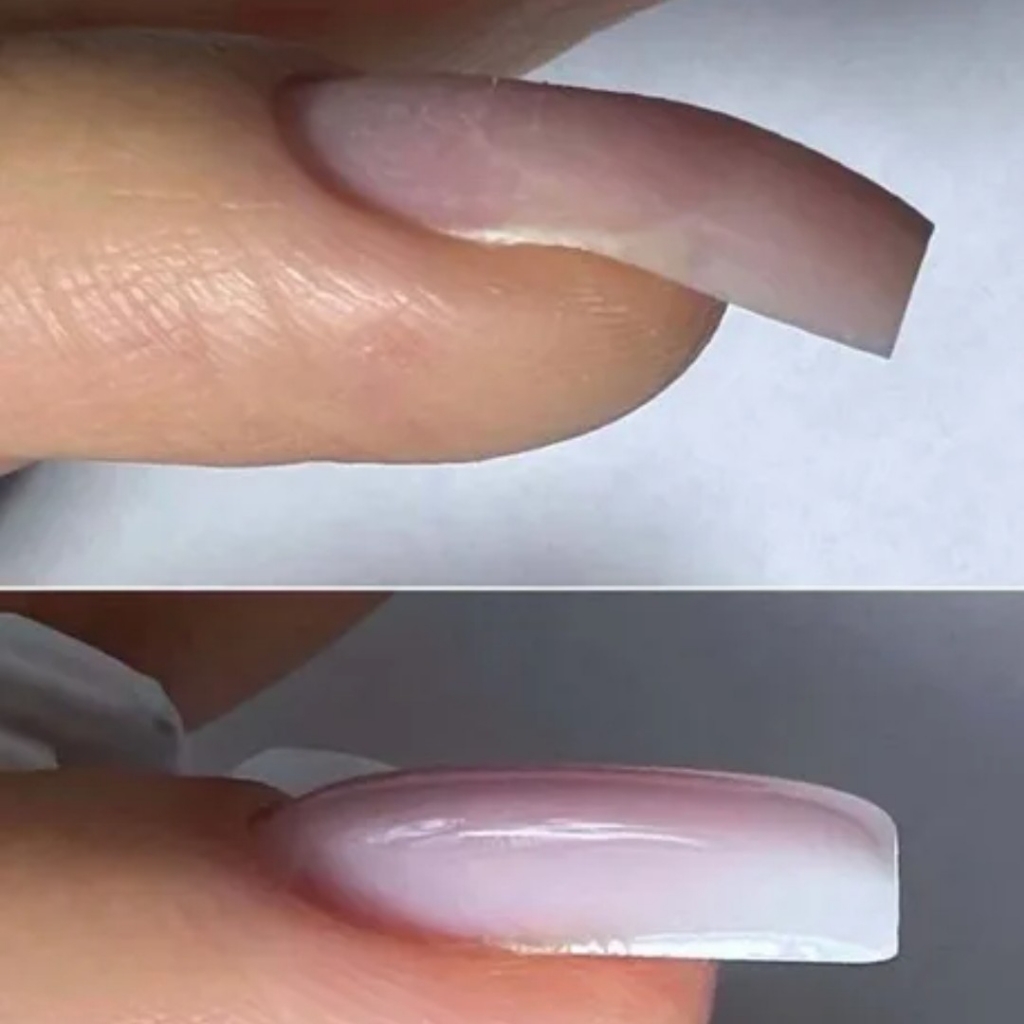 Поднятие клюющих ногтей (1ноготь)