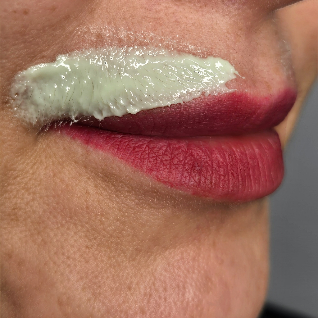 УДАЛЕНИЕ ПУХА