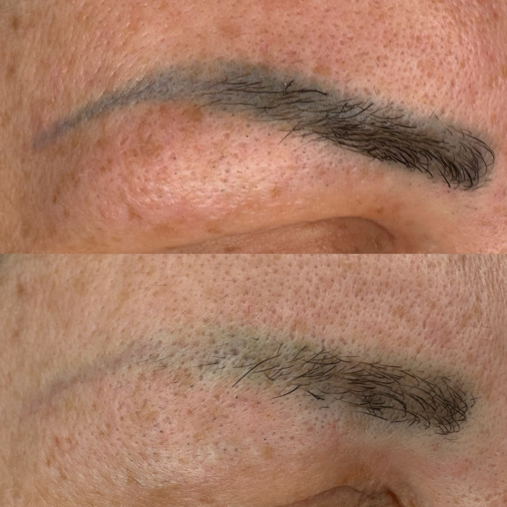 Осветление (удаление) нежелательного ПМ