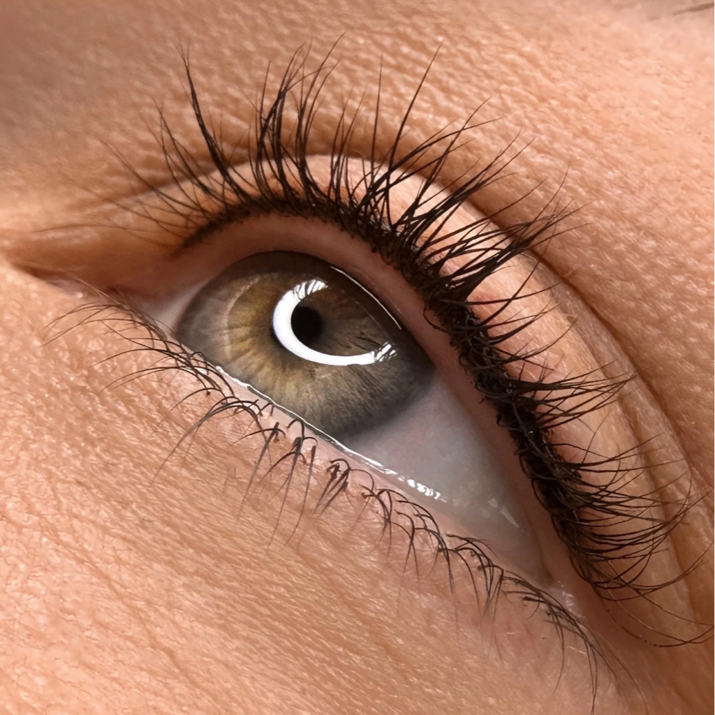 Межресничка