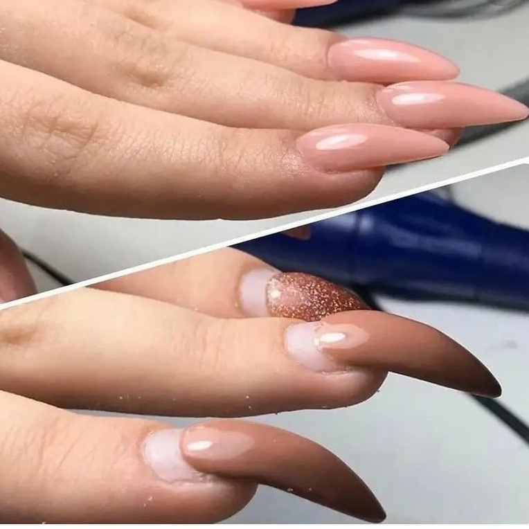 Гелевая коррекция