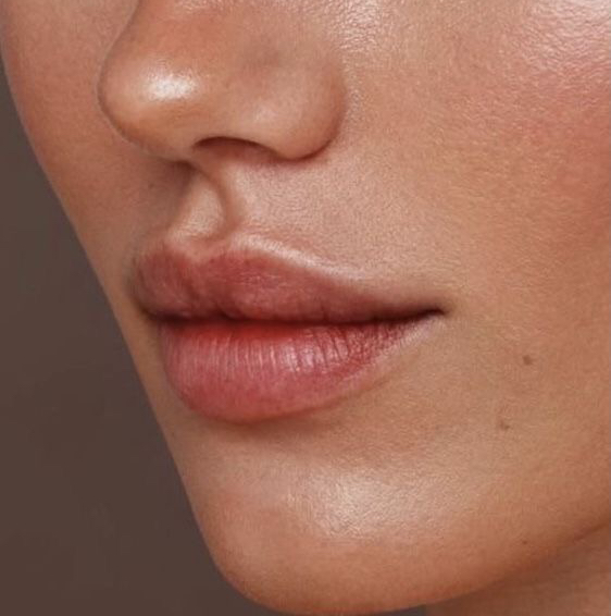 Удаление нежелательных волос (одна зона)