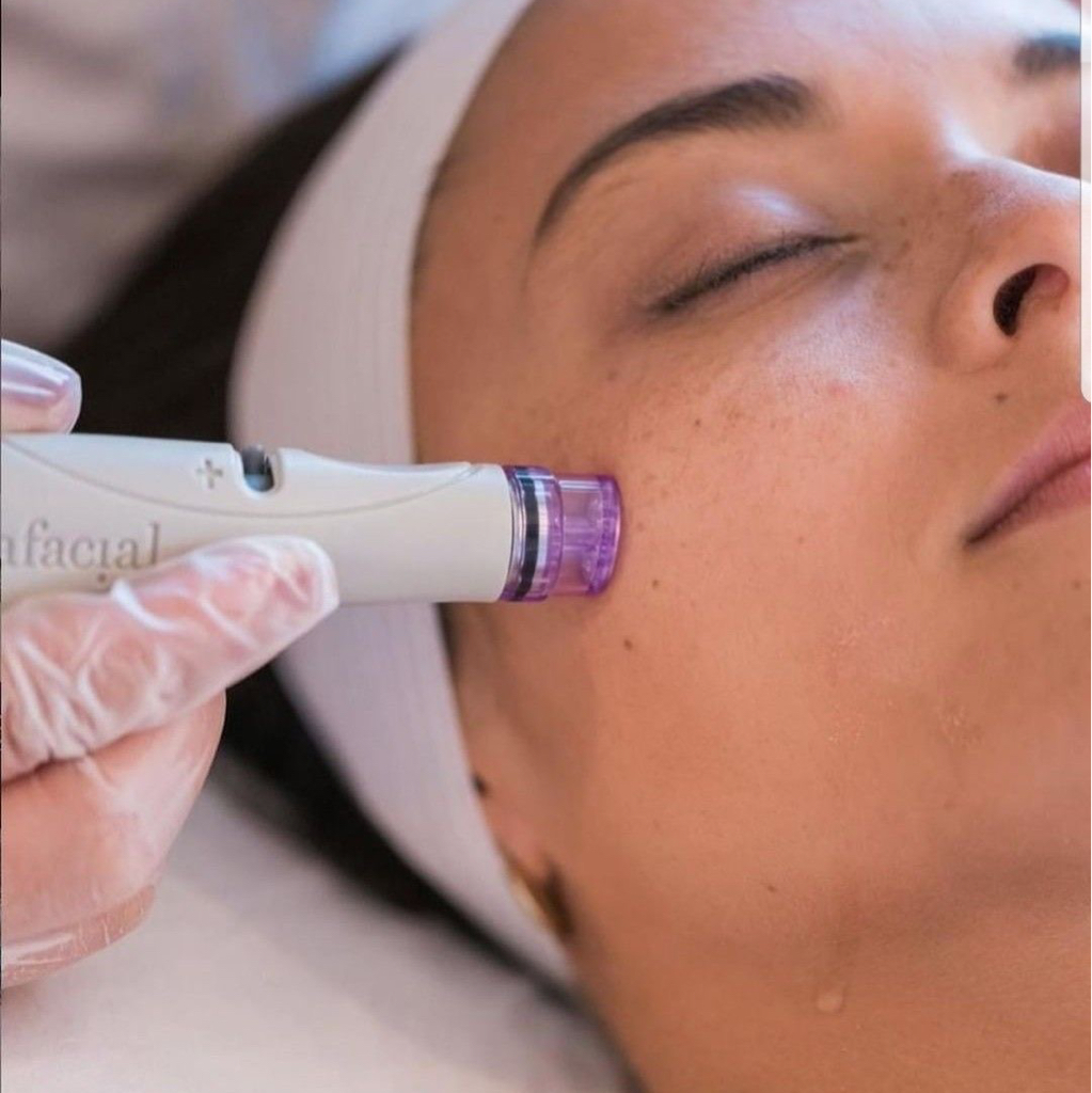 Фракционная мезотерапия