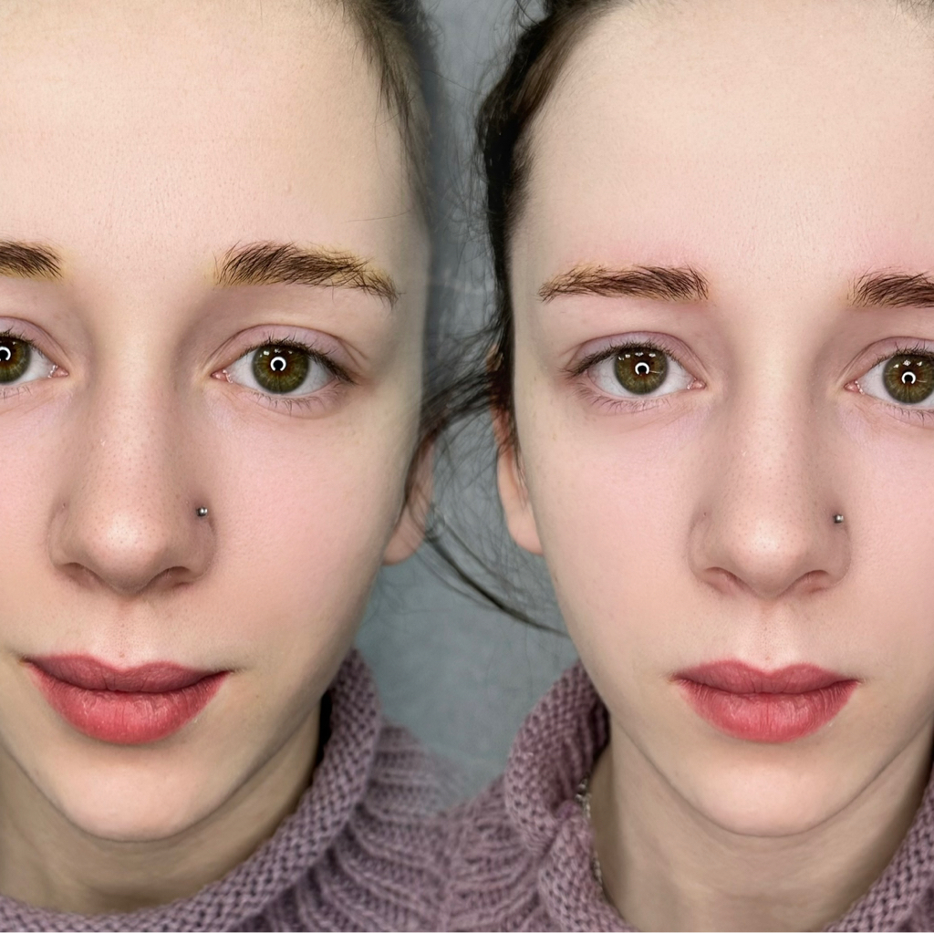 Удаление ремувером (брови, веки, губы)