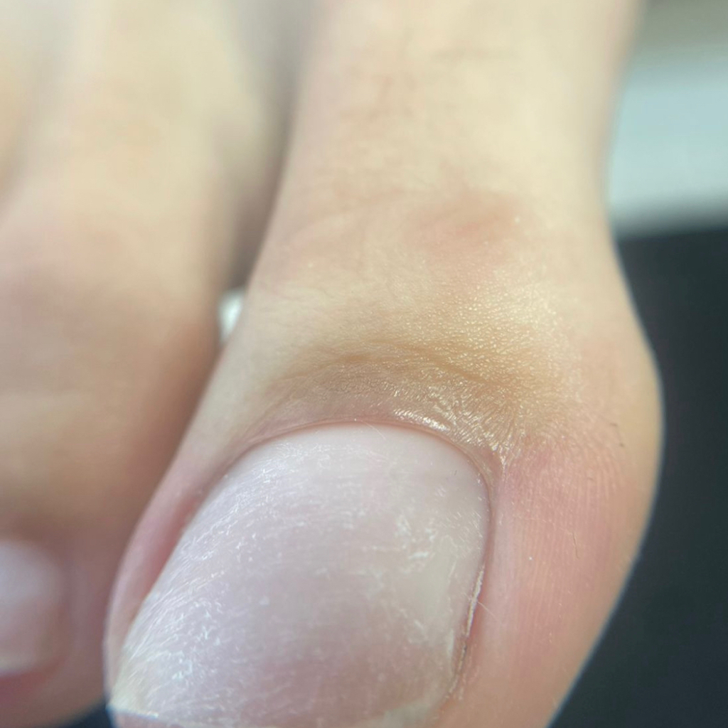 Гигиенический SMART педикюр