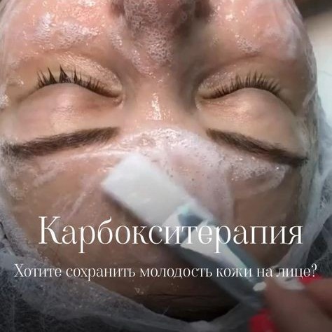 Карбокситерапия