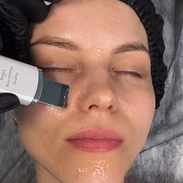 УЗ чистка лица