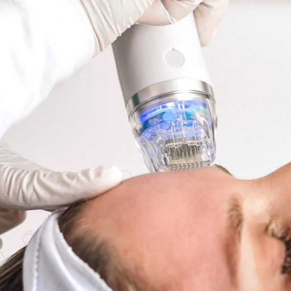 Микроигольчатый RF лицо/шея/декольте