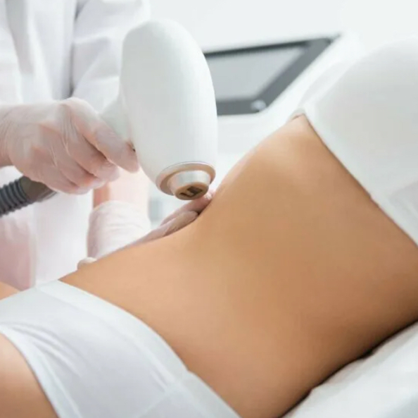 Линия живота лазер