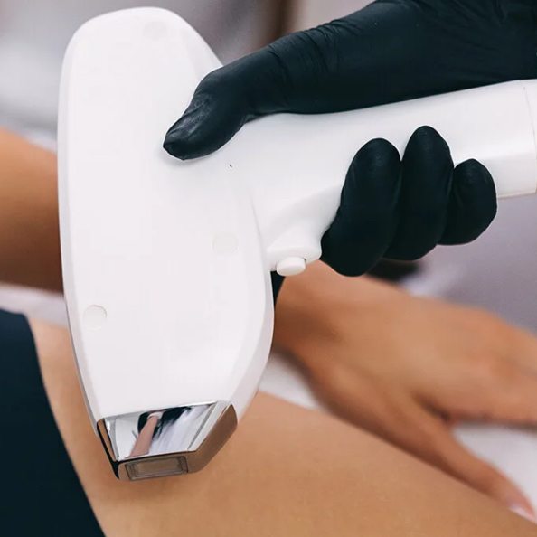 Межбровье лазер