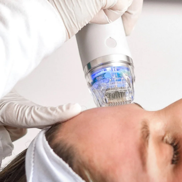 Микроигольчатый RF лицо