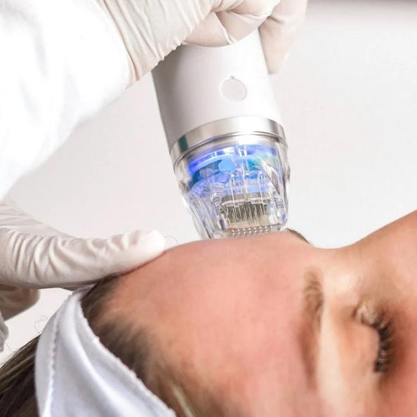 Микроигольчатый RF (шея+декольте)