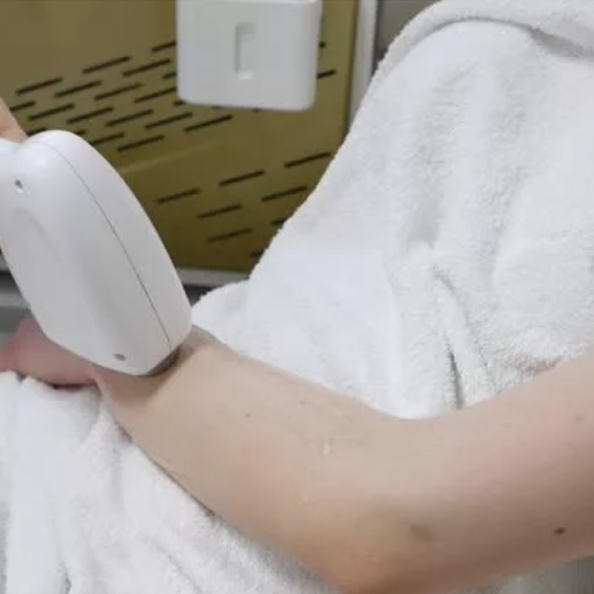 Руки полностью лазер