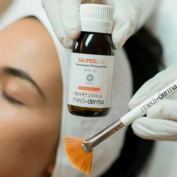 Пилинг SESDERMA (акне)