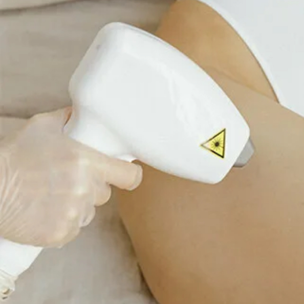 Бикини классика лазер