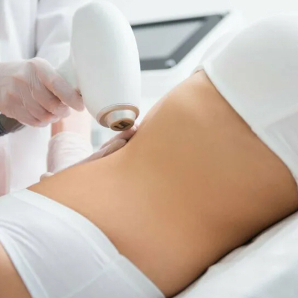 Живот полностью лазер