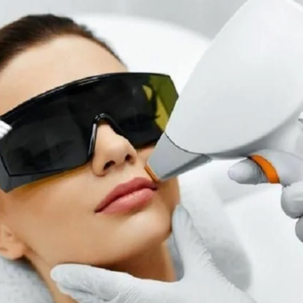 Зона над губой (усики) лазер