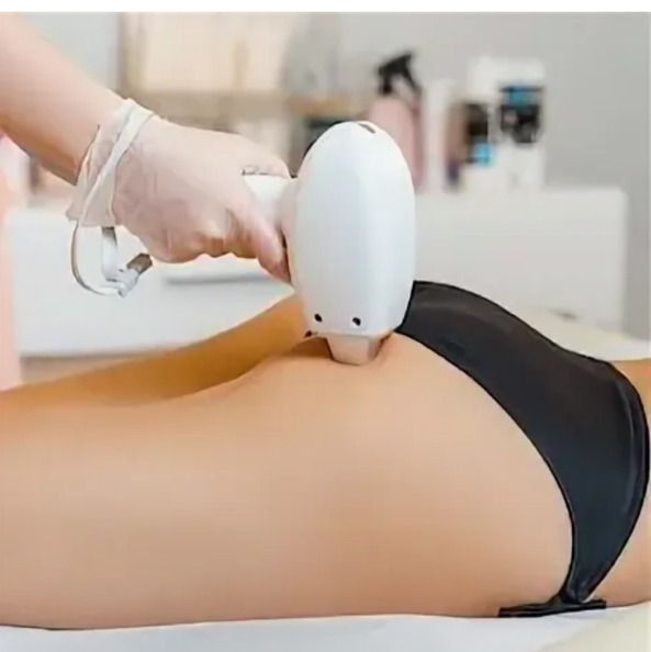 Ягодицы лазер