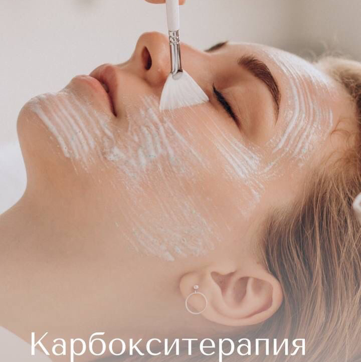 Карбокситерапия