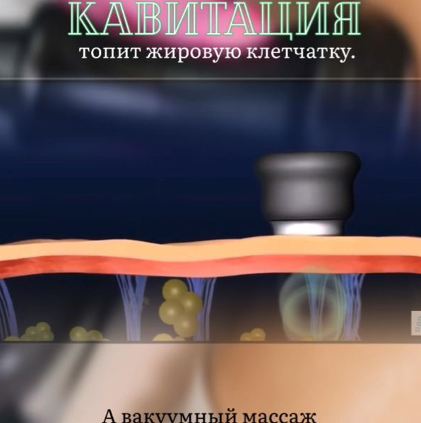 Кавитация