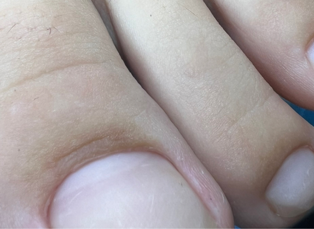 педикюр гигиенический стопа ,пальчики – без покрытия