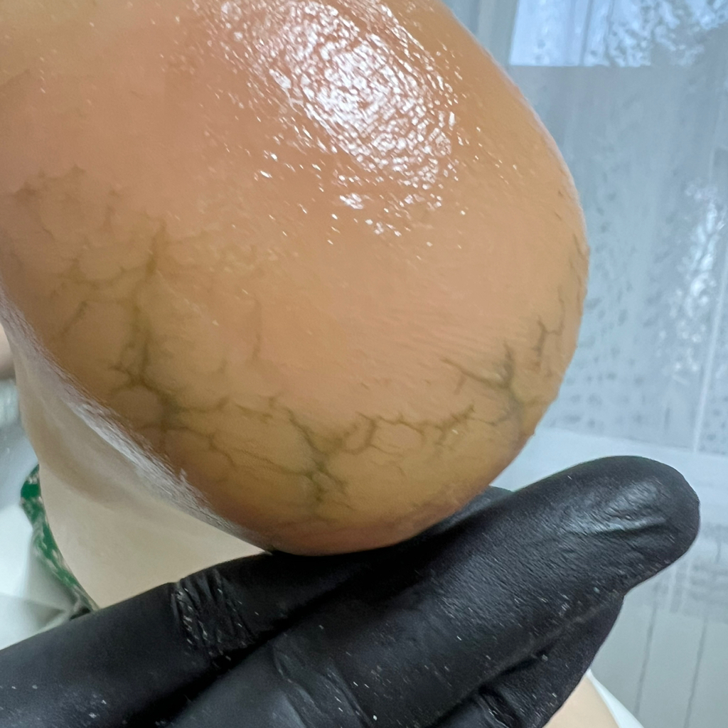 лечебный педикюр Карт