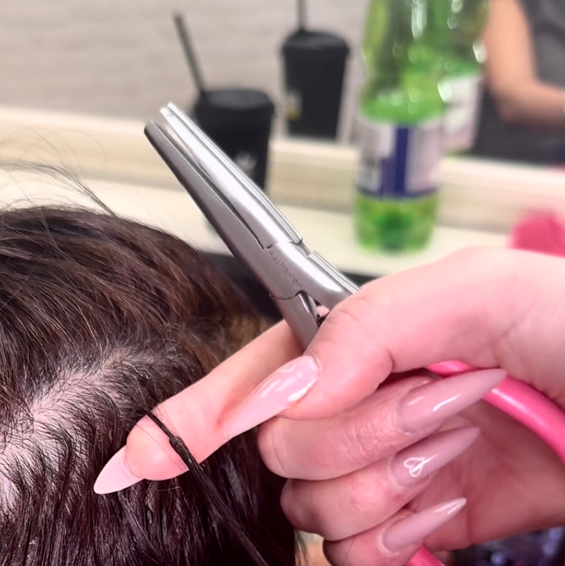 Снятие донорских волос