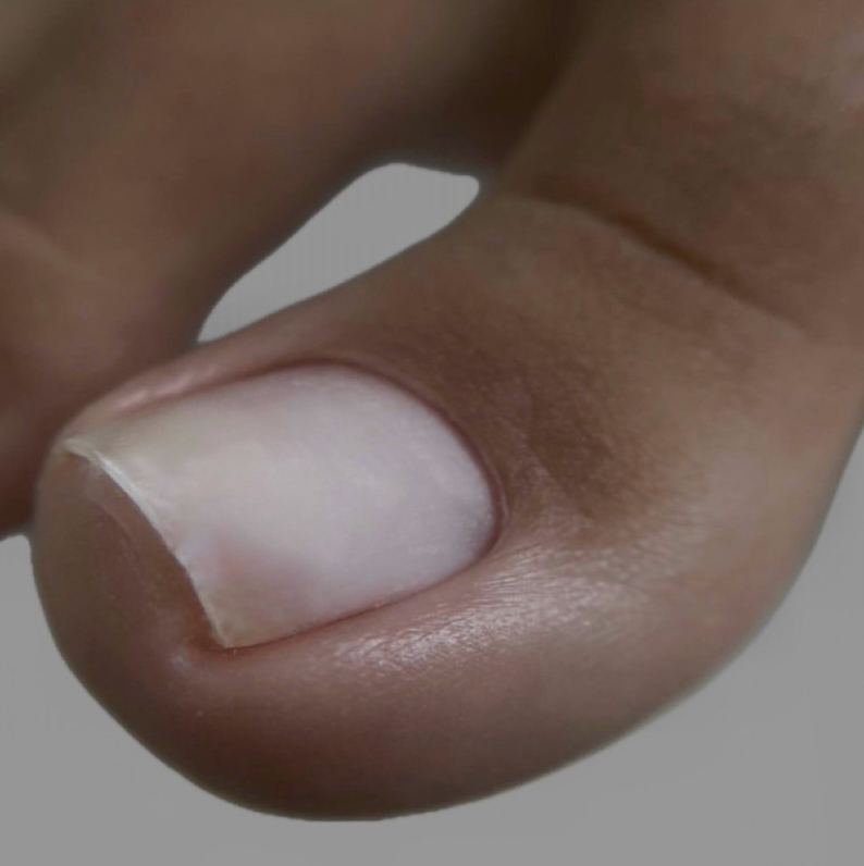 Педикюр обработка стопы без покрытия