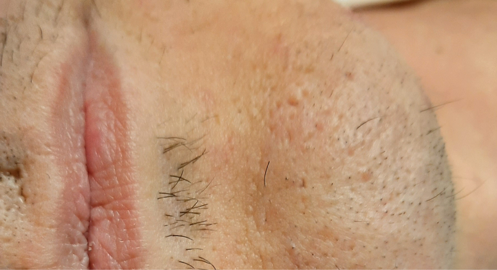 Подбородок