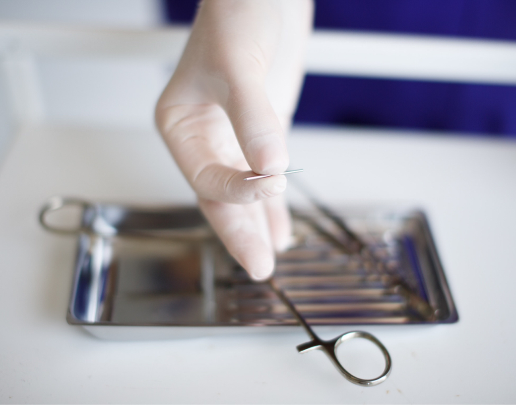 Восстановление прокола мочки (без использования иглы)