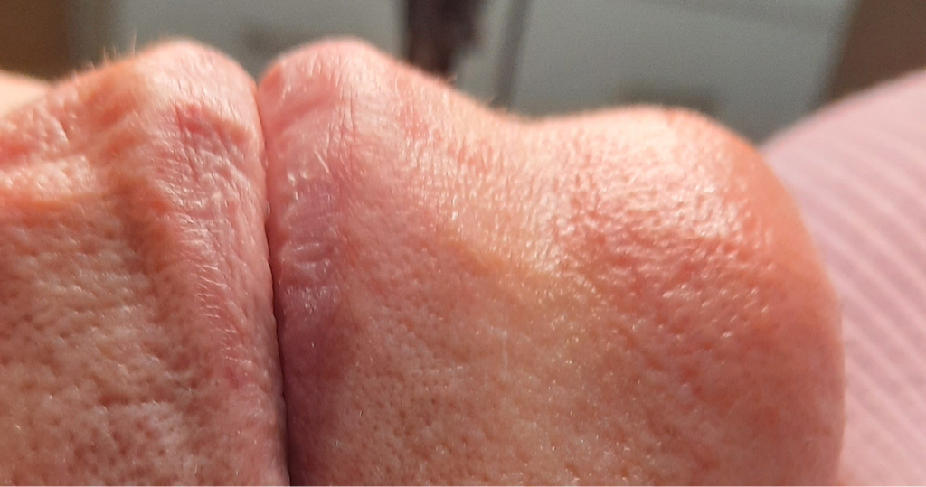 Зона над верхней губой