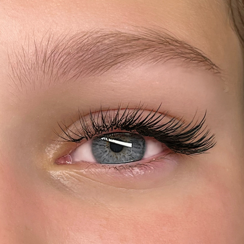 Неполное наращение