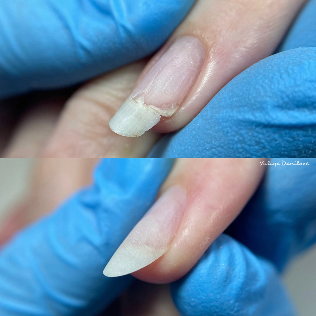 Ремонт 1 ногтя