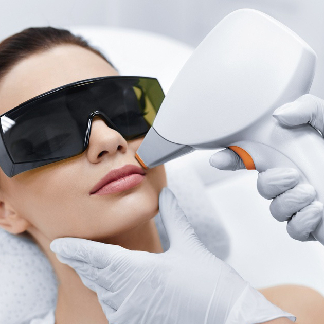 Лазерная эпиляция «Лицо»