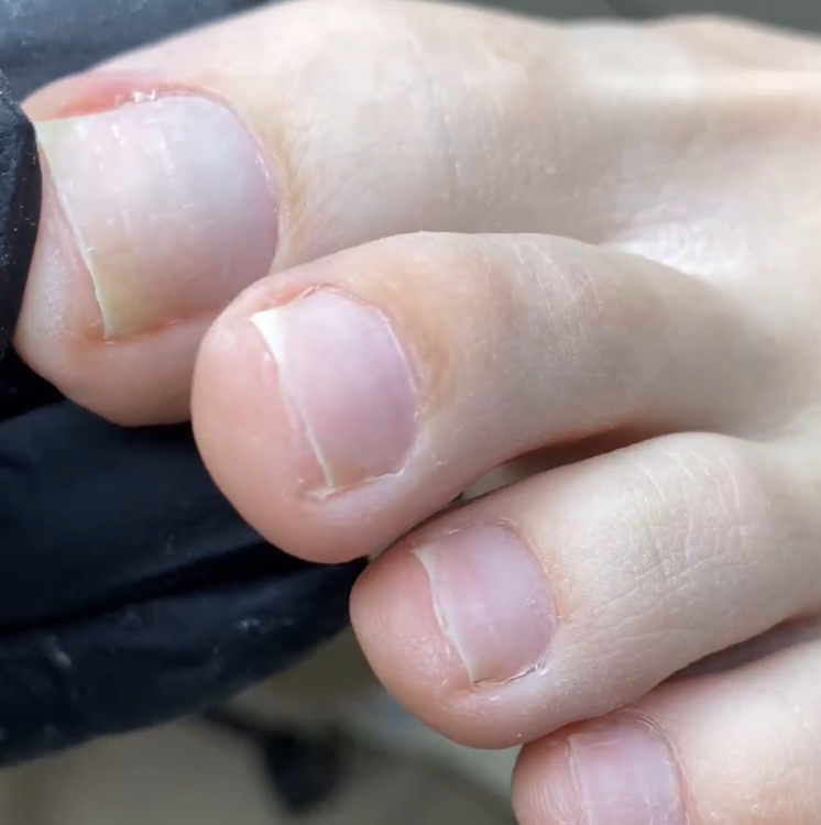 Гигиеническая обработка пальчиков