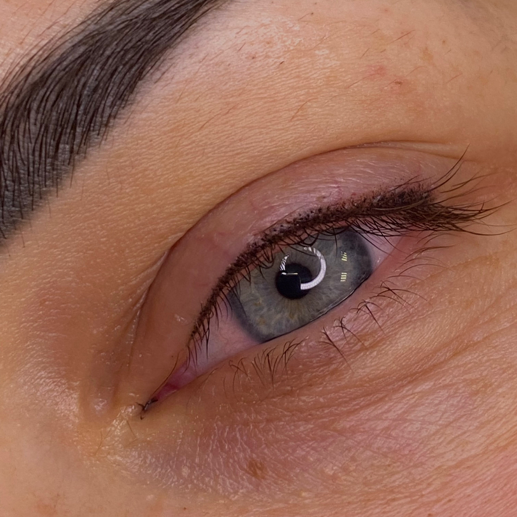 Межресничное пространство