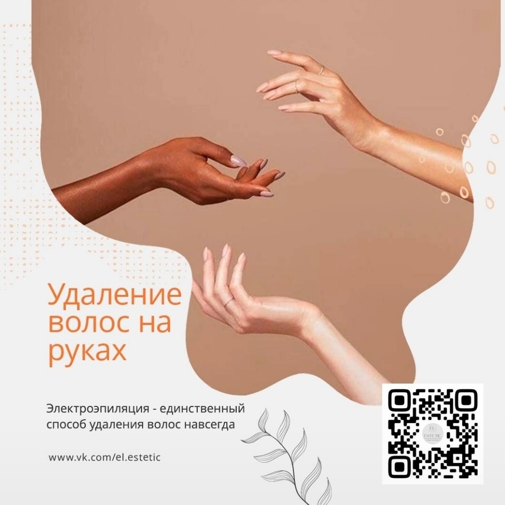 Электроэпиляция руки