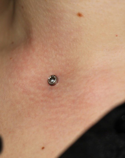 Чистка микродермала | Clean microdermal