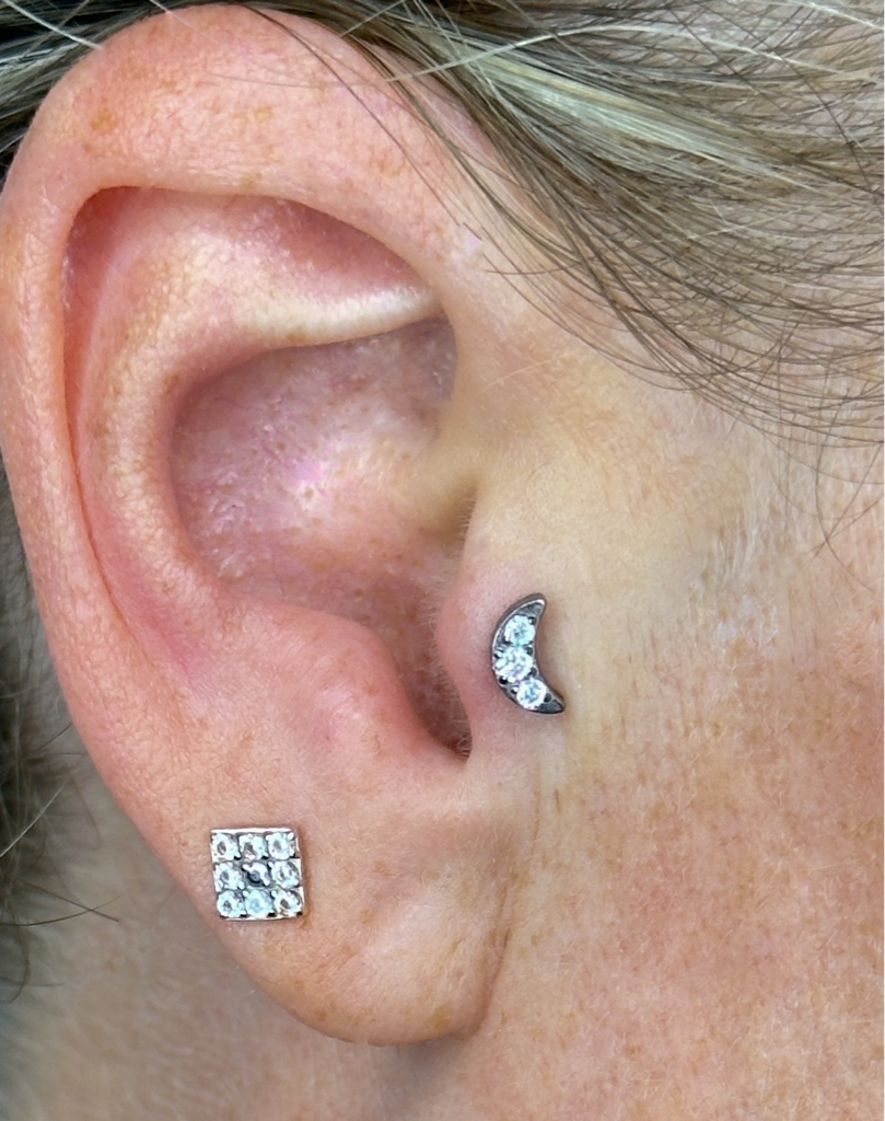 Трагус | Tragus