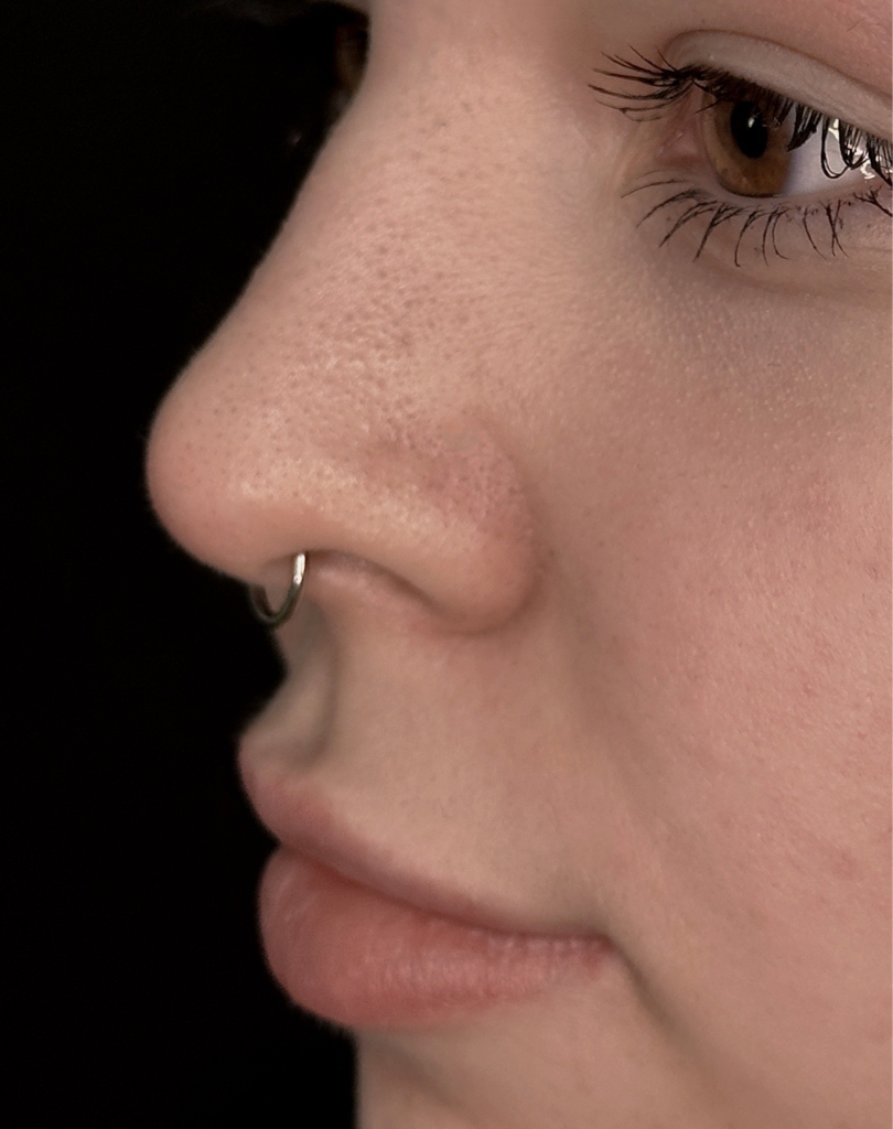 Септум | Septum