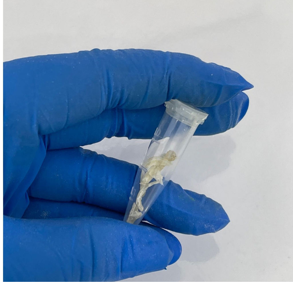 Сбор материала и микроскопический анализ на грибок.   Основными проявлениями, которые указывают на необходимость сдачи анализа на грибок: видоизменённ