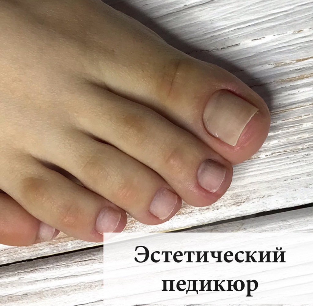 Гигиенический педикюр (когда нет подологических проблем).  Стоимость - 15.000 тенге