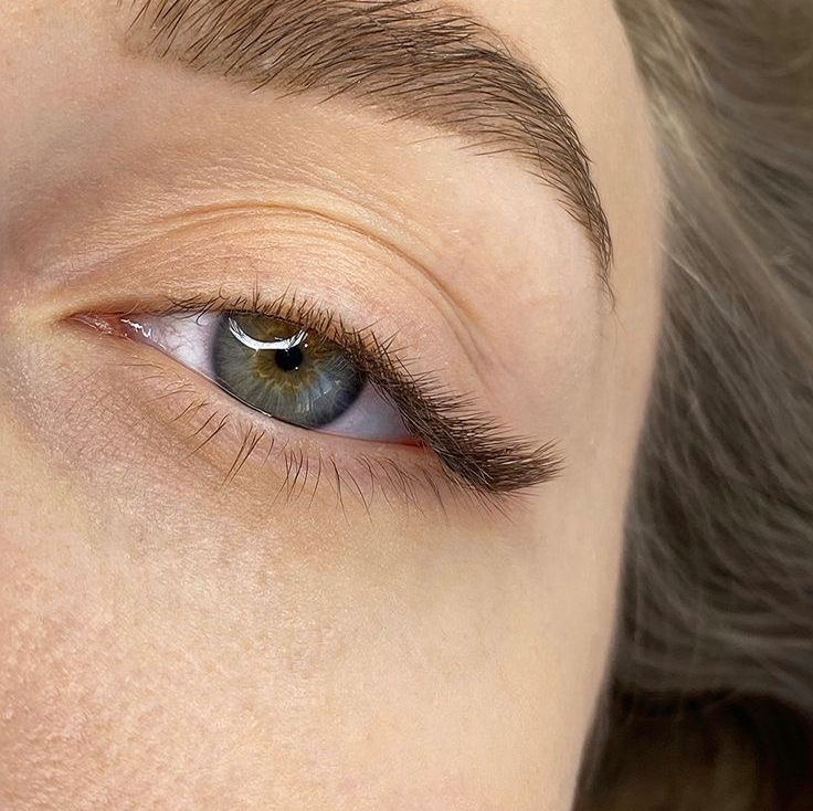 Уголки глаз