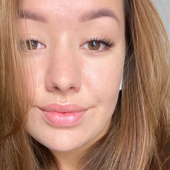 Неполное наращивание (классика)