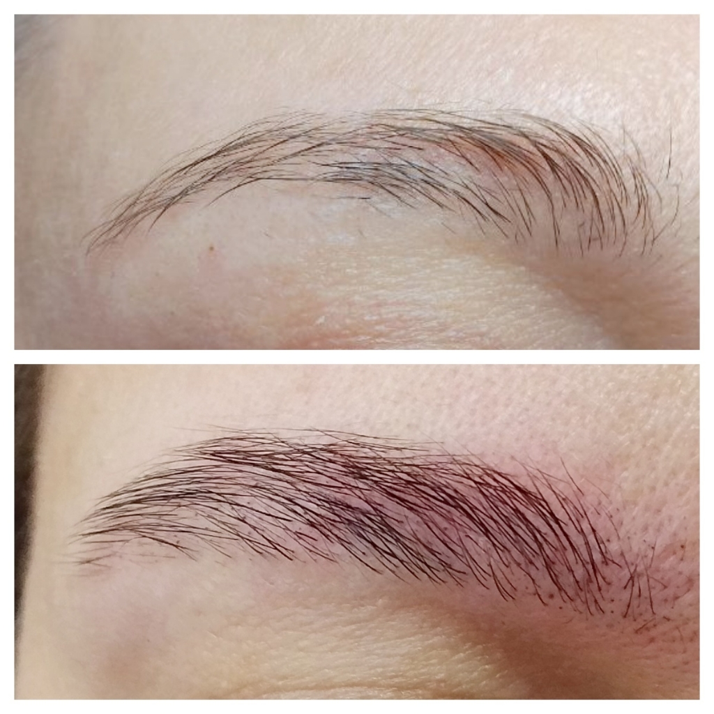 Восстановление бровей