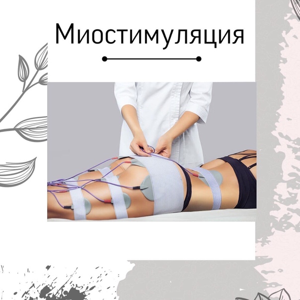 Миостимуляция