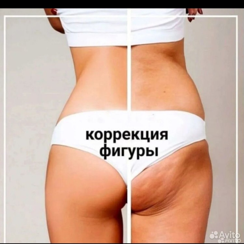 Процедура Жиротоп