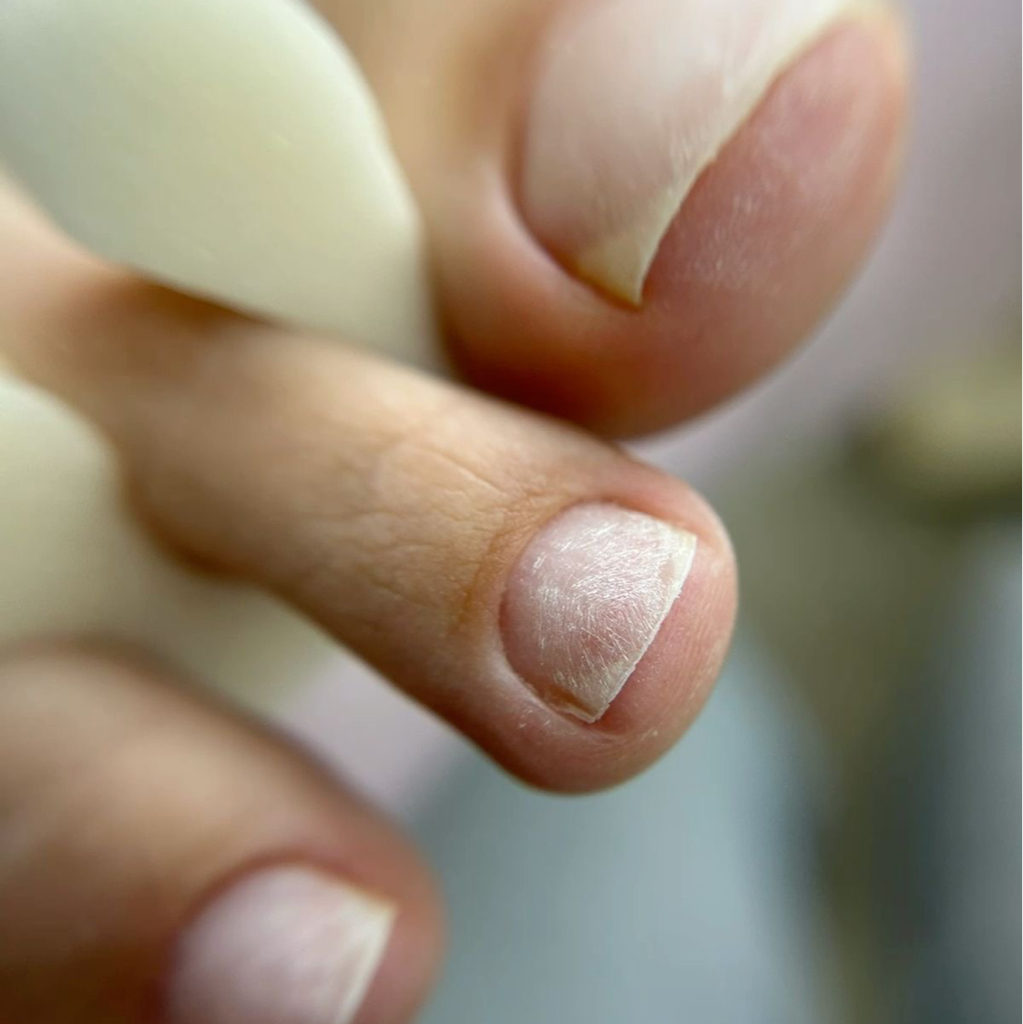 Педикюр  пальчики