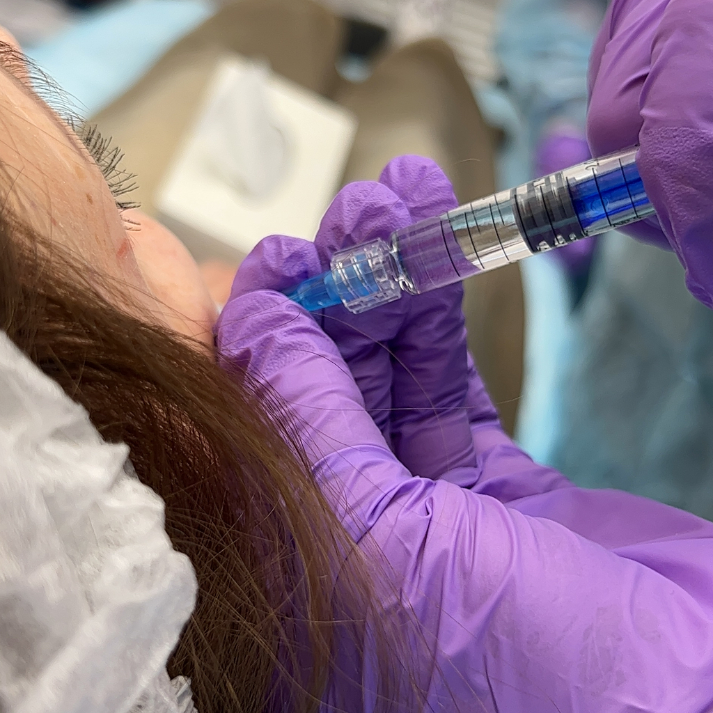 Контурная пластика лица