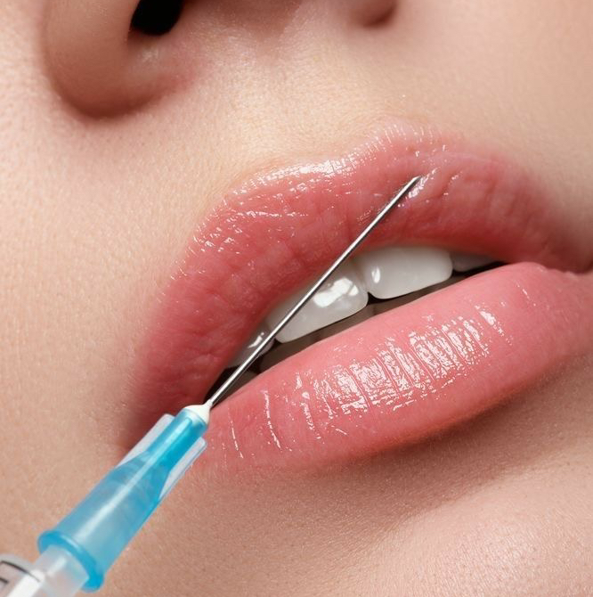 Juvederm ultra 3 1ml